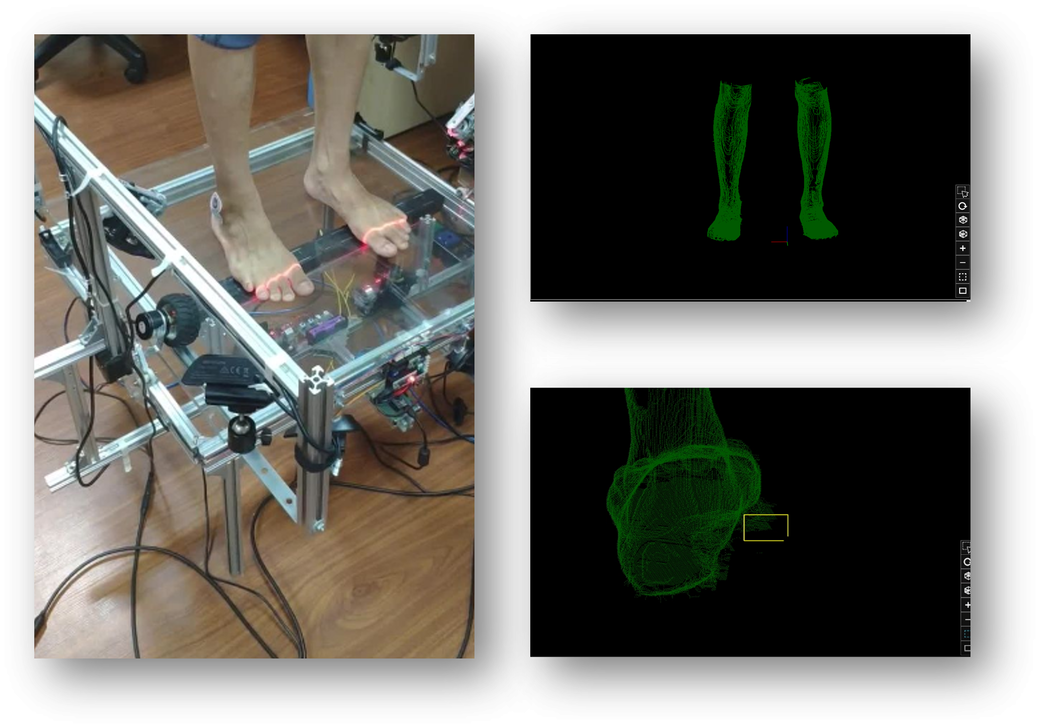 3Dフットスキャナー開発