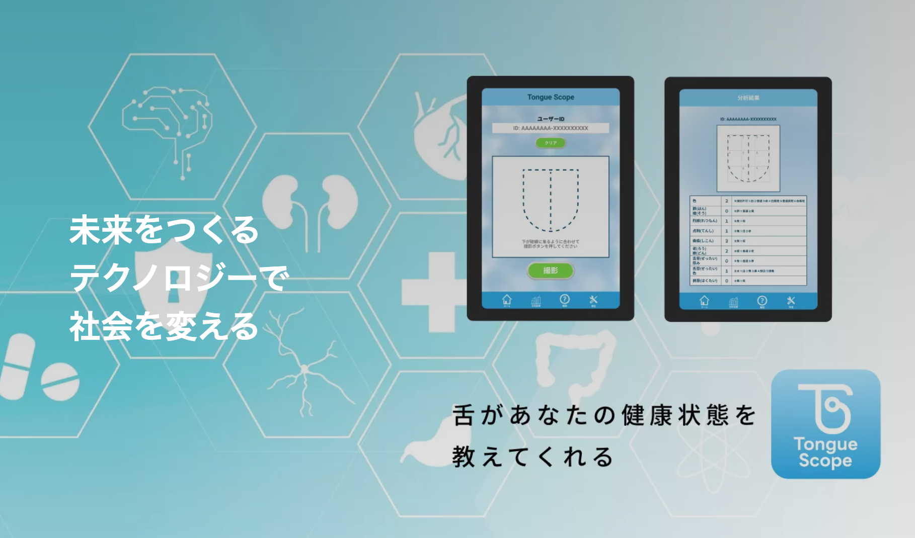 舌診AI：株式会社パルセック